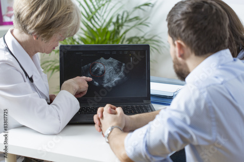 Showing fetus ultrasound photo