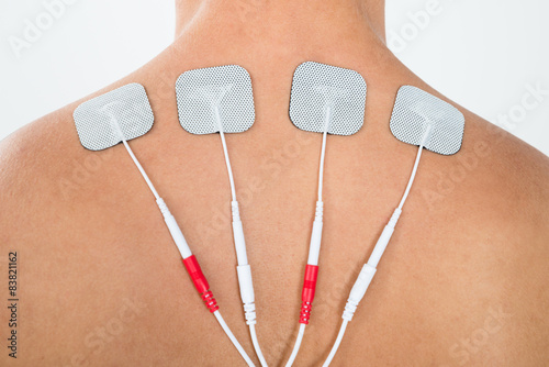 Man With Electrodes On His Back photo