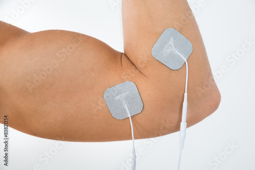 Person Biceps With Electrostimulator Electrodes