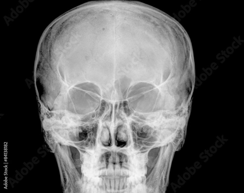 Obraz na płótnie Front face skull in x-ray image