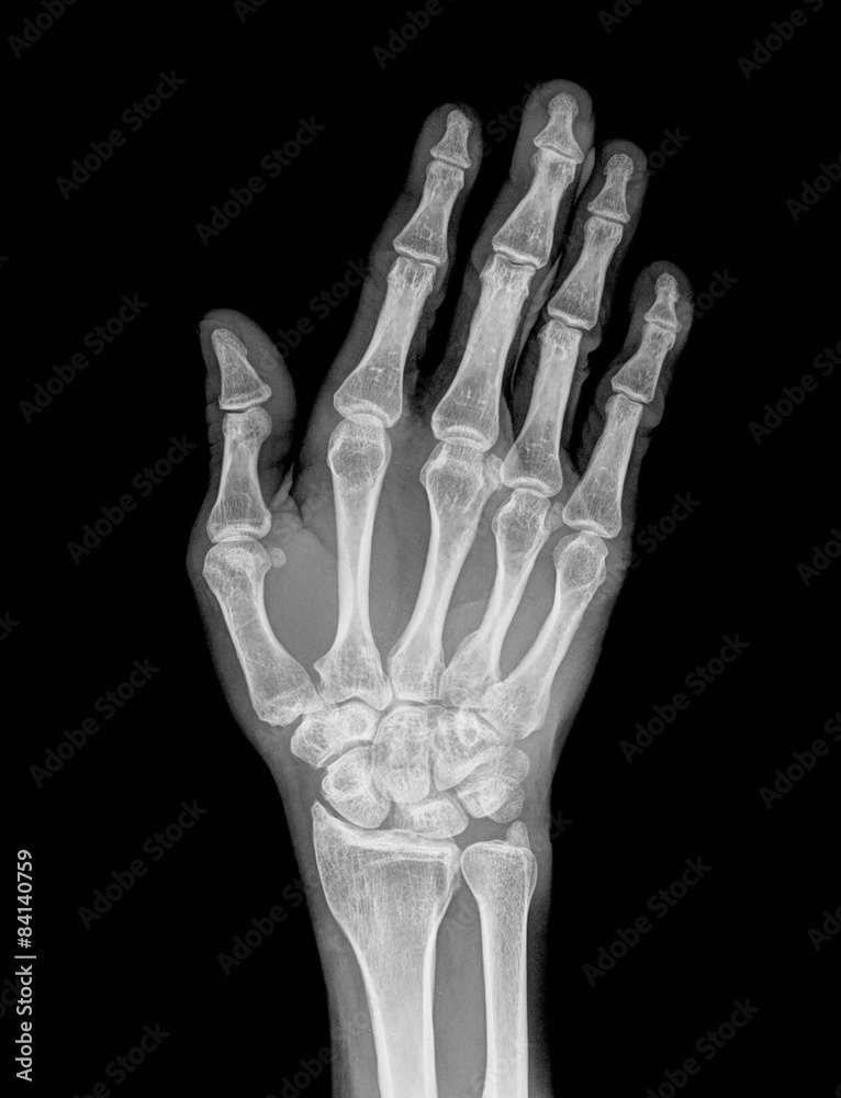 Hand xray image medical background Hand xray image medical background