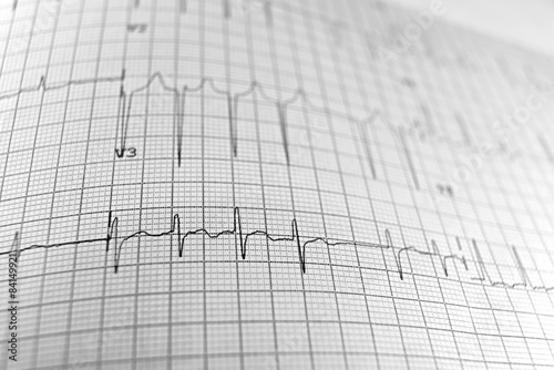 Wallpaper Mural Electrocardiogram Torontodigital.ca