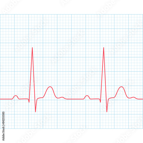 Medical electrocardiogram - ECG on grid
