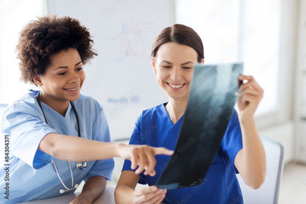 happy female doctors with x-ray image at hospital happy female doctors with x-ray image at hospital