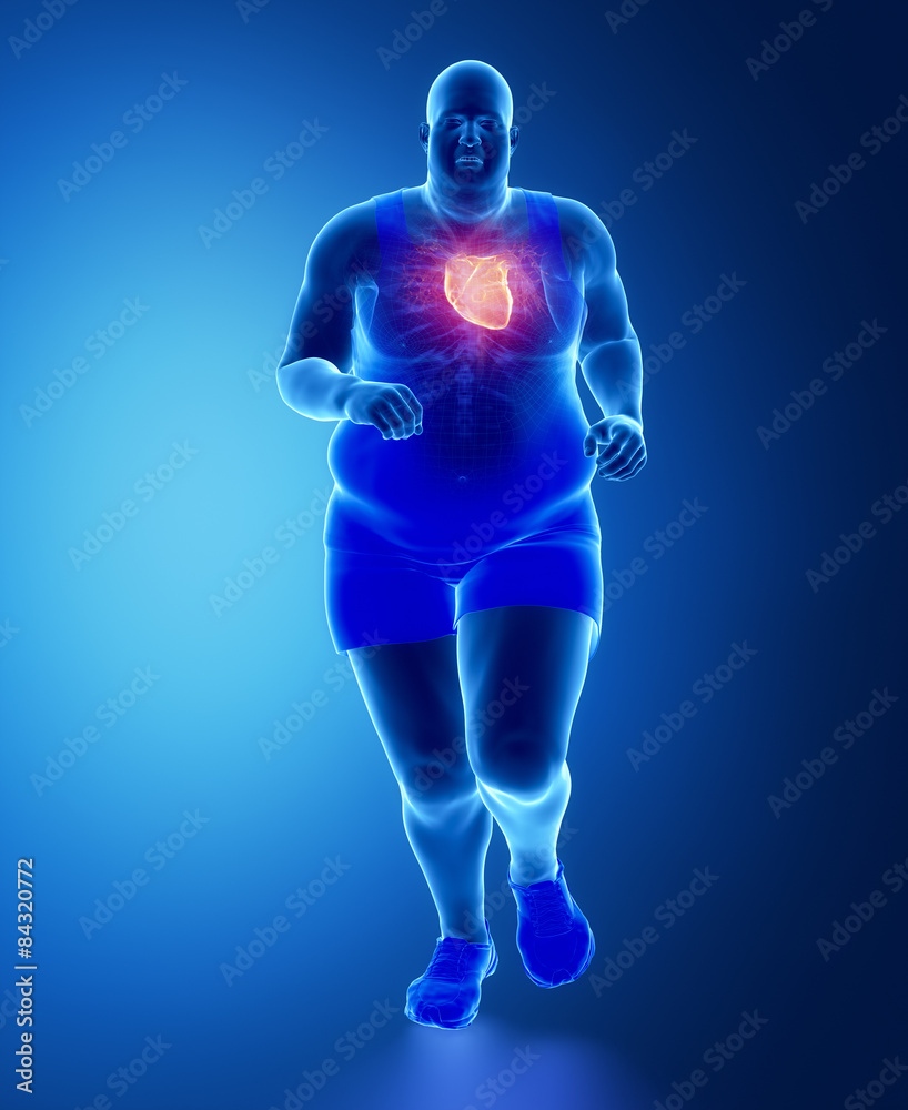 Fat obese man running with heart attack concept Fat obese man running with heart attack concept