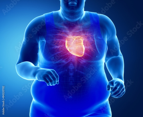 Obraz na płótnie Fat obese man running with heart attack concept