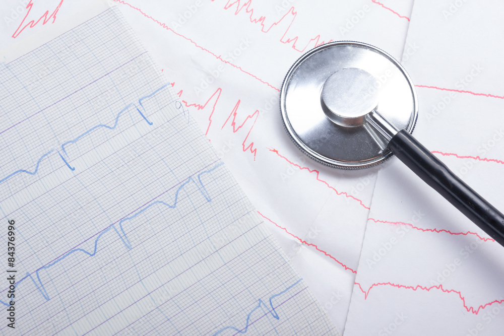 Fototapeta premium Cardiogram pulse trace and stethoscope concept for cardiovascular medical exam, closeup.
