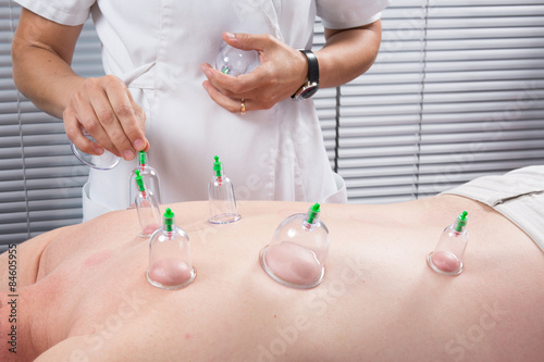 Close-up Of Therapist's Hand Placing Cups On body