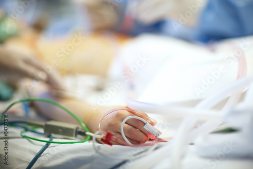 Hand of a patient with inserted plastic transfusion system