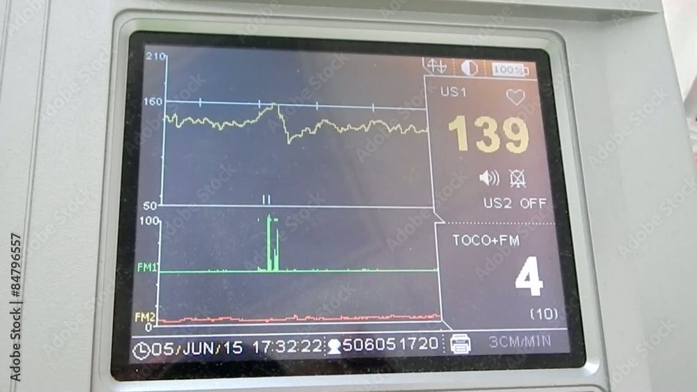 Cardiograph printing and recording heart rate Cardiograph printing and recording heart rate