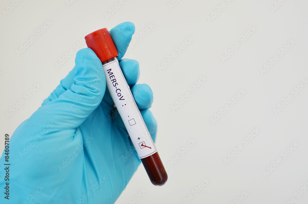 Naklejka premium MERS-CoV positive