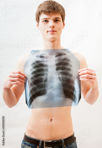 young man with naked chest holding x-ray image of lungs