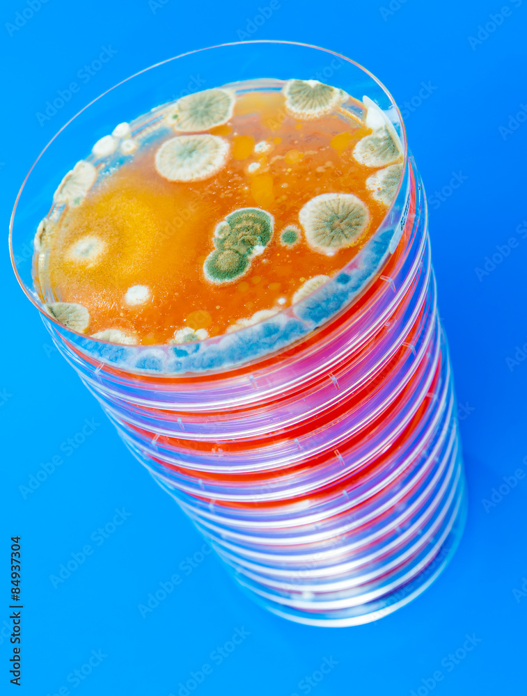 Petri dish with bacteria colonies Petri dish with bacteria colonies