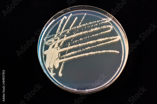 Petri dish with bacteria colonies
