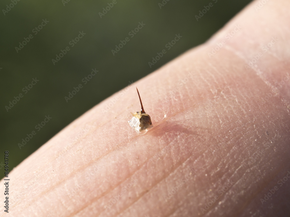 Bee Sting - a weapon of defense and attack.