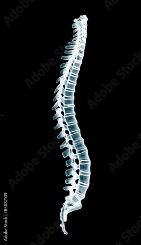 human spine isolated on a black background xray photo