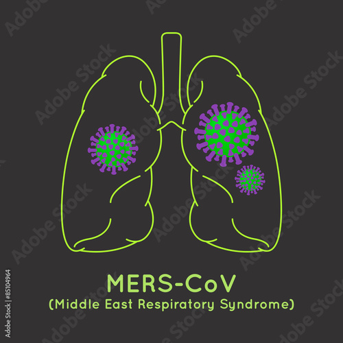 MERS-CoV(Middle East respiratory syndrome coronavirus) image ill