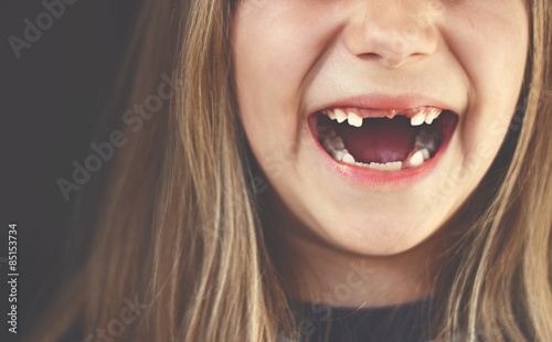 Close up of smiling toothless girl photo