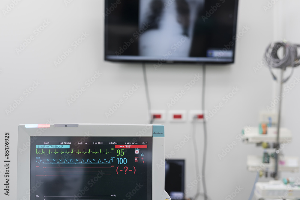 medical monitor in operation room medical monitor in operation room