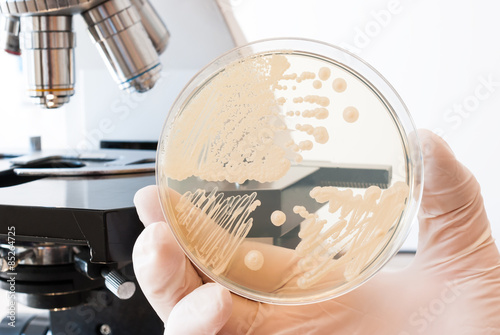 Laboratory doctor hand with gloves holding petri dish with bacteria. Laboratory microscope in the background photo