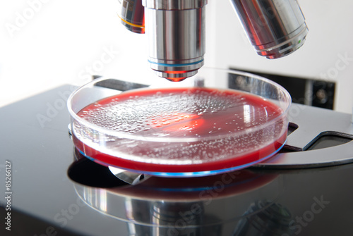 Bacteria colonies on petri dish under the light of the microscope