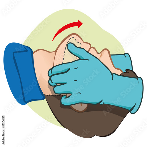 First Aid resuscitation (CPR), clearing breathing, positioning with gloves