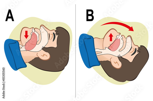 First Aid resuscitation (CPR), clearing breathing, positioning.