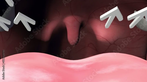 3D medical animation showing the anatomy of the human nose and explaining several reasons for snoring.
Part1 photo