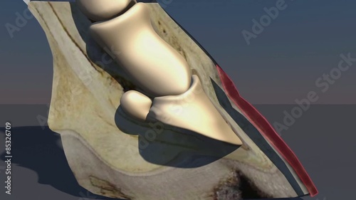 3D medical animation showing the anatomy of  a horse hoof and explaining different types of Laminitis. Rotation, sinking and founder.
Part 2: photo