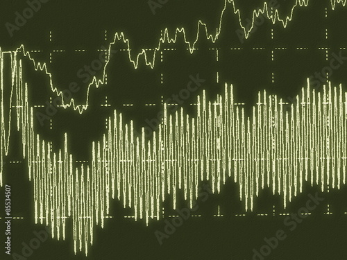 Obraz na płótnie Brain wave on electroencephalogram EEG for epilepsy