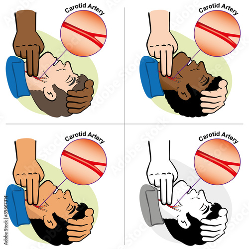 First Aid pulse through the carotid artery, ethnicities