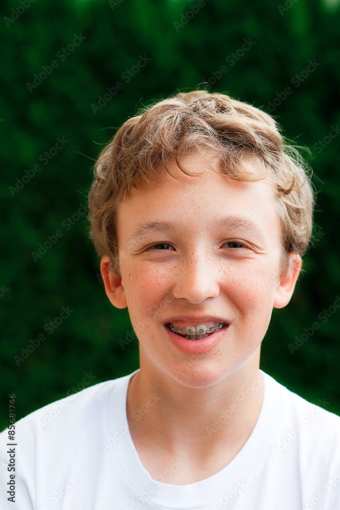 Outdoor portrait of a teenage boy with braces. Outdoor portrait of a teenage boy with braces.
