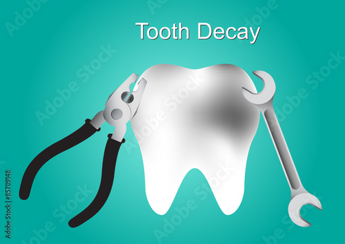 Tooth decay, Tooth decay treatments, tooth vector