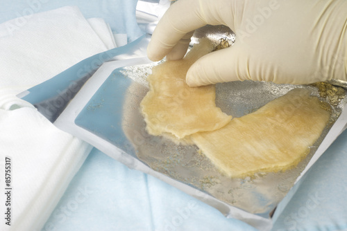 Φωτογραφία Hydrogel Burn Dressing