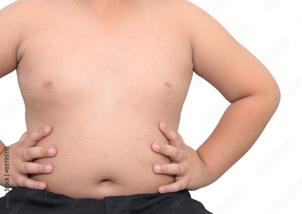 The size of stomach of children with overweight isolated. The size of stomach of children with overweight isolated.