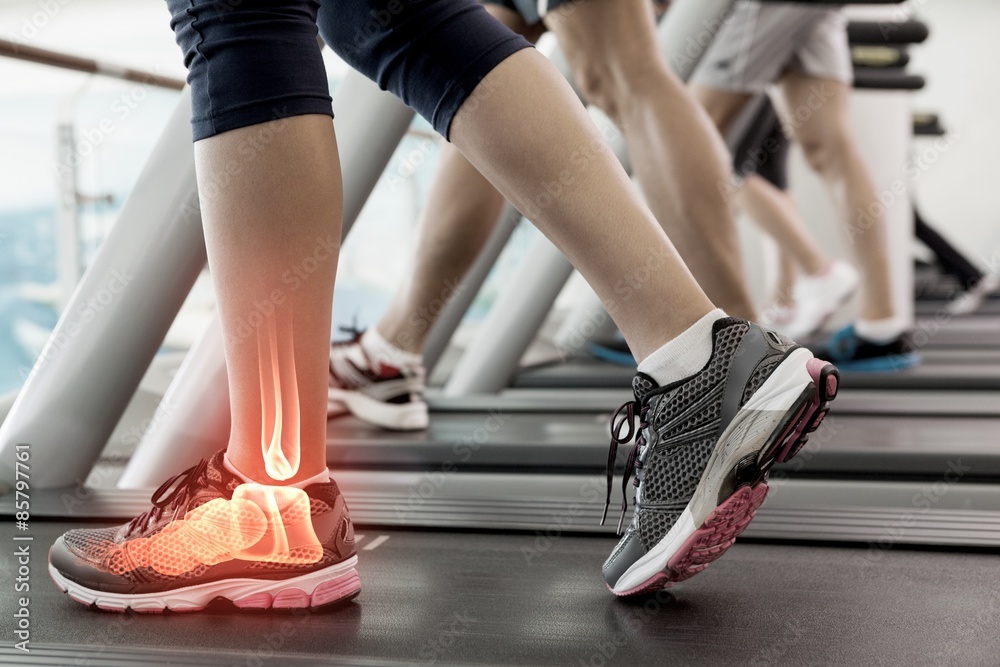 Highlighted ankle of woman on treadmill Highlighted ankle of woman on treadmill