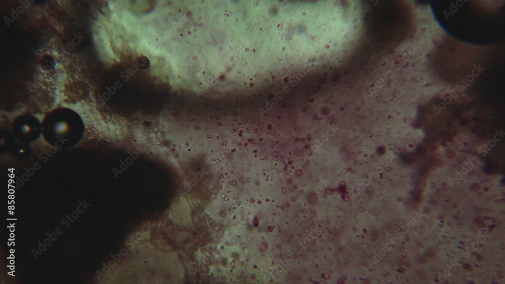Chemical reactions of melting laundry detergent under microscope. Stock