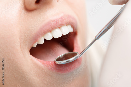 Close-up of woman having her teeth examined  photo