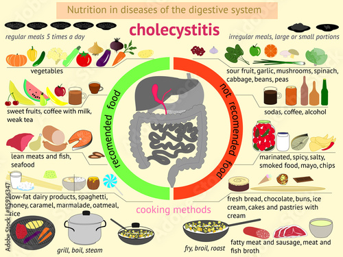 infographics proper nutrition in diseases of the digestive system. Cholecystitis
 photo