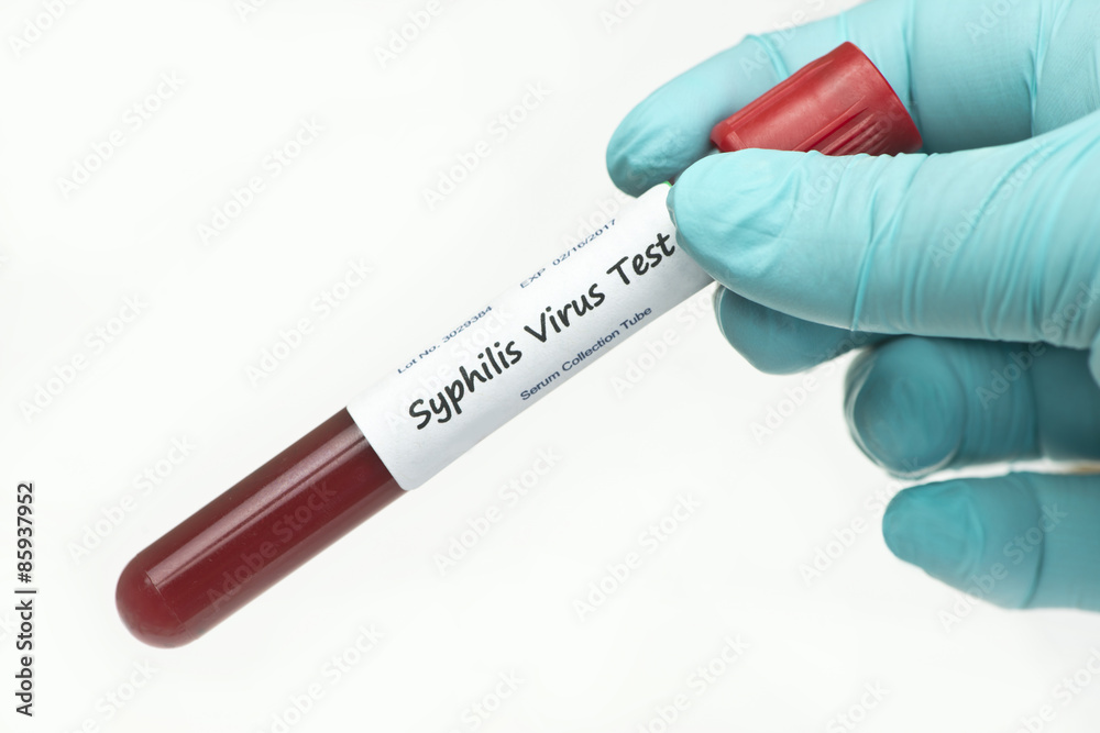 Obraz premium Syphilis Test Panel