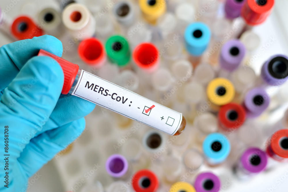 Fototapeta premium Blood sample with MERS-CoV (Middle East respiratory syndrome coronavirus) negative