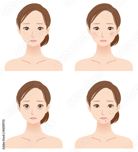 40代女性 美容 肌トラブル 顔セット Stock イラスト Adobe Stock 40代女性 美容 肌トラブル 顔セット Stock イラスト Adobe Stock