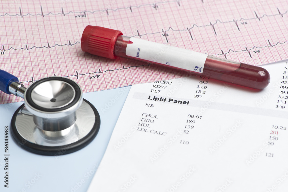 Lipid Panel EKG Lipid Panel EKG