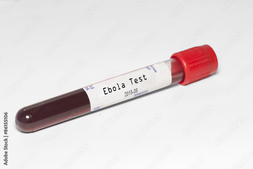 Ebola Test Ebola Test