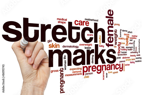 Stretch marks word cloud