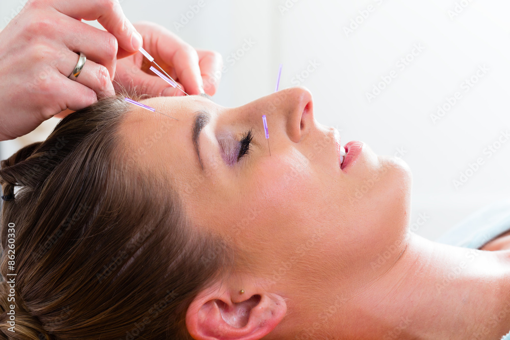 Frau bei Akupunktur mit Nadeln im Gesicht