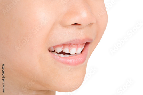 Smile teeth from kid