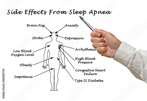 Side Effects From Sleep Apnea photo