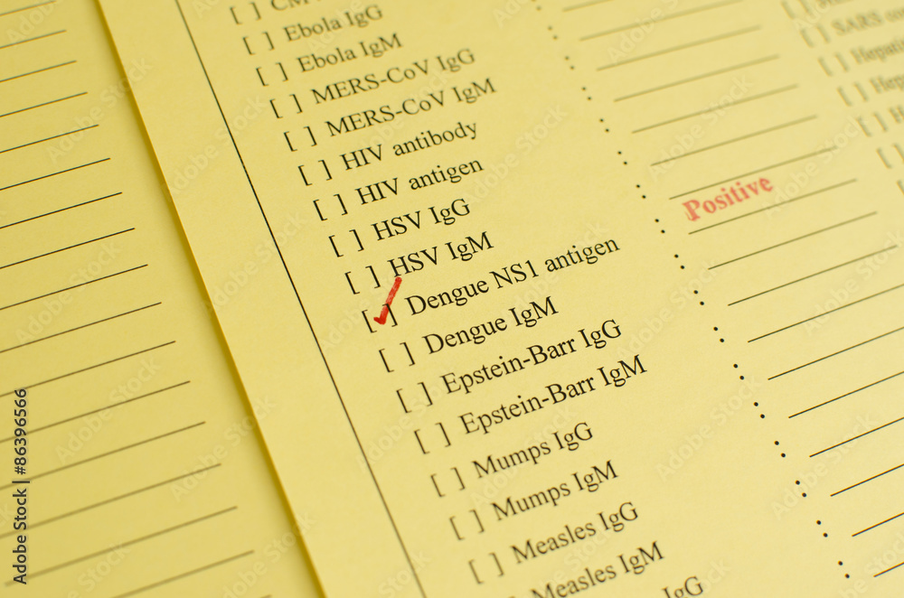 Obraz premium Dengue virus positive