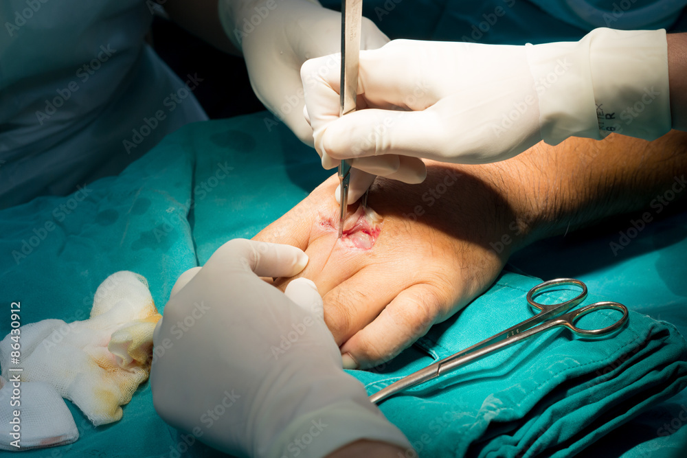 Hand Suergery Hand Suergery